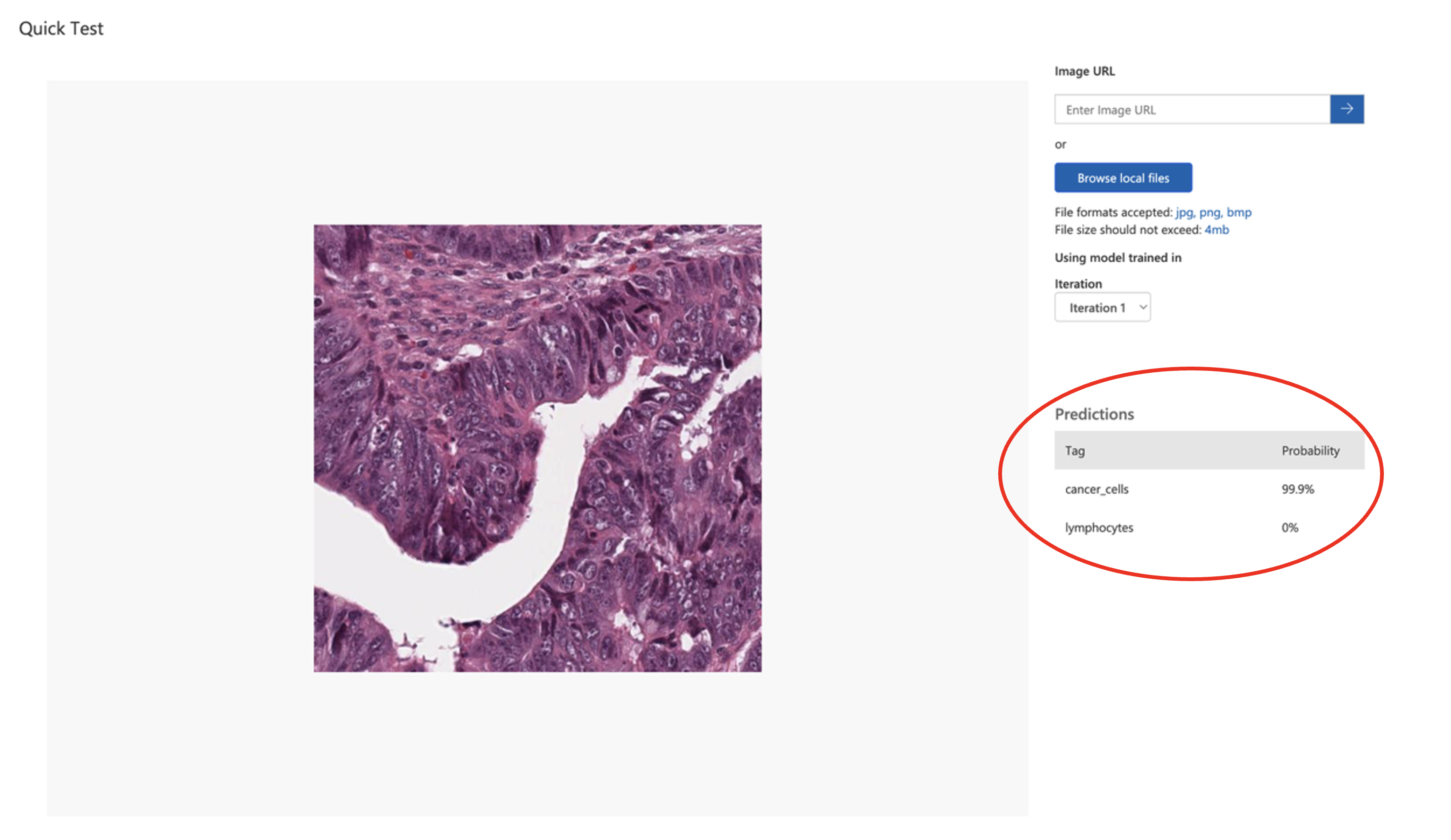 Quick Test results showing histopathology image with prediction results table